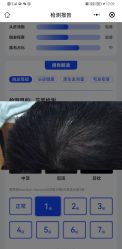 -雍禾植发
