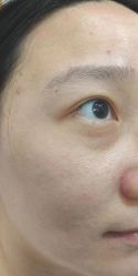 -北京美痣堂古方祛痣斑疣瘊