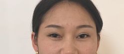 -杭州美莱医疗美容医院