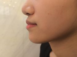 -长沙雅美医疗美容医院