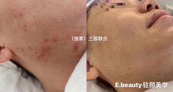 -E.beauty驻颜·痘敏肌调理中心