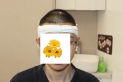 -大麦微针植发丨全国连锁