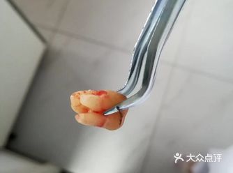 智齿总是发炎勇敢和它说拜拜