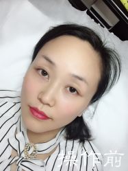 点击看大图 -西施无菌半永久纹绣眉眼影唇轻增发纹发际线