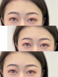 -杨益美学·野生眉半永久纹眉发际线