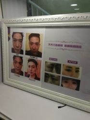 -天津健丽·去眼袋医疗美容机构
