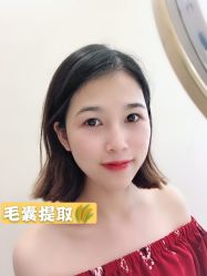 -大麦微针植发全国连锁