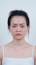 -佛山曙光金子医学美容医院