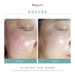 -MJ skin care国际皮肤管理中心
