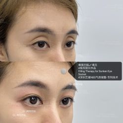 -深圳艺星医疗美容医院