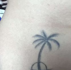 -杭州米兰柏羽医疗美容医院