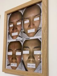 -美肤盾祛痘·问题肌头疗管理中心