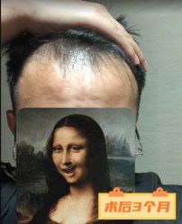 -雍禾植发全国连锁