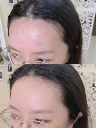 -西施无菌半永久纹绣眉眼影唇轻增发纹发际线
