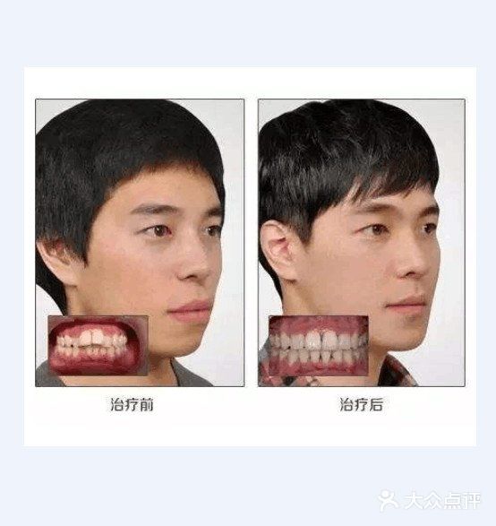 听说矫正牙齿会很痛？会不会伤害牙齿呢？