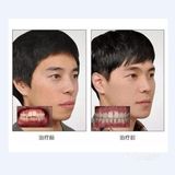 听说矫正牙齿会很痛？会不会伤害牙齿呢？