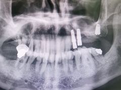 -牙博士口腔品牌连锁(杨浦店)