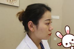 -大麦微针植发丨全国连锁