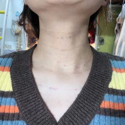 体验后-上海玫瑰医疗美容医院