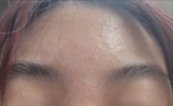 -E.beauty驻颜·痘敏肌调理中心