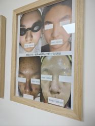 -美肤盾祛痘·问题肌头疗管理中心