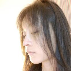 点击看大图 体验后-广东韩妃整形外科医院