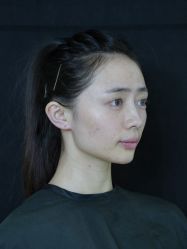 -Yestar重庆艺星医疗美容医院