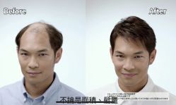 -发饰美男士增发补发假发定制店