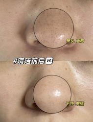 -Cream88颜皮肤管理中心