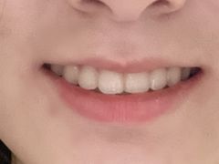 -深圳佑诺口腔门诊部