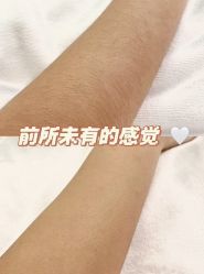 -薇兰专业脱毛连锁机构