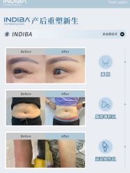点击看大图 -半岛故事·法儿曼抗衰·indiba中心
