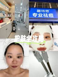 -蕾特恩专业祛痘国际连锁