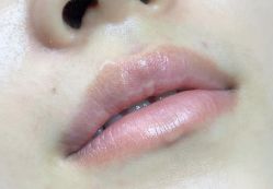 -德绣·机器野生眉发际线·美瞳线半永久