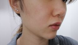 -新美荟医美·专注面部美学抗衰