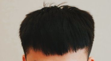 -大麦微针植发全国连锁