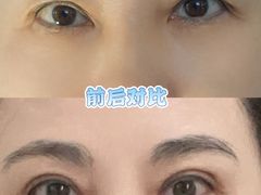 -深圳大学总医院