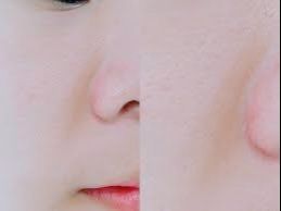 -SKINIST丽铂医疗美容