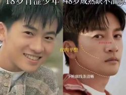 -倩极·精研痘敏肌管理