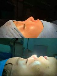 体验后-成都西区医院整形美容