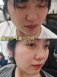 -天津伊美尔医疗整形美容专科医院