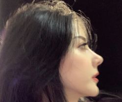 -成都西区医院整形美容