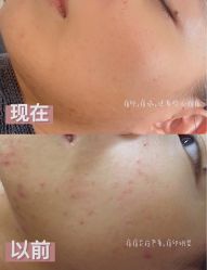 -苗方清颜痘肌研究所