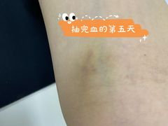 -广州仁爱天河医院体检中心