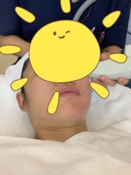 体验前-恒妍医美·韩国定制抗衰中心