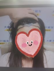 -大麦微针植发丨全国连锁