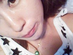 现在的眼睛很大了！-上海华安整形外科门诊部