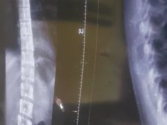 -张钰强中医正骨推拿连锁(华发商都店)