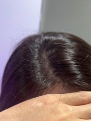 -熙朵美学植发连锁