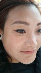 -爱莎扁平疣·汗管瘤·斑痣中心